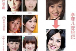 西安整容爆料事件视频最新,揭秘行业乱象，患者权益引关注